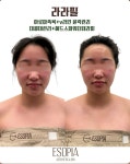 에소테릭명상에스테틱 | 에소피아에스테틱