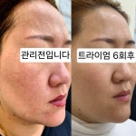 최선희뷰티앤스킨 | 지아뷰티앤스킨