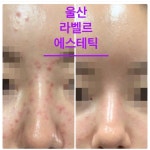 라벨르 에스테틱 울산남구점