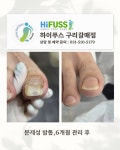 포쉬네일 하이푸스 구리갈매점