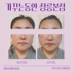 가꾸는동안 은평본점 | 가꾸는동안 정릉본점