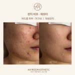 이룸디자인스킨왕십리역사점 | 아룸에스테틱 왕십리센트라스점