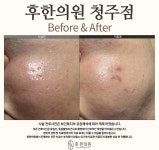 후한의원 청주