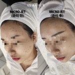 후기