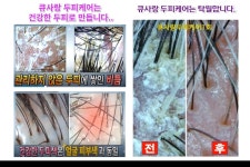 미앤미 스킨앤바디&큐사랑 센텀역점 | 큐사랑 재송점