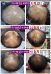 미앤미 스킨앤바디&큐사랑 센텀역점 | 큐사랑 재송점