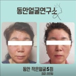 동안애젊어지는동안전문샵 | 동안얼굴연구소