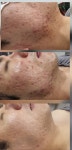 골드뷰티앤숲칼프 | 뷰티앤숲칼프