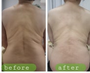 골드뷰티앤숲칼프 | 뷰티앤숲칼프