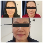 벨라뷰티 바이 닥터한스파 | 뷰티인벨라