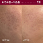 리엔케이보령지사;장미스킨케어 | 리엔케이스킨케어