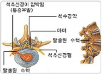 알즈너 천안건행대리점