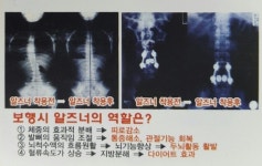 알즈너 천안건행대리점