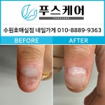 푸스케어수원이든네일 | 푸스케어 수원호매실점 네일가게