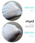 선스킨랩 | 마이디스킨랩