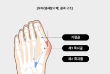 알즈너 태영대리점