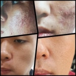 더이엔클리닉 | 더이앤 뷰티클리닉센터
