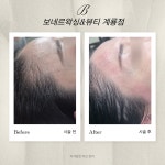 보네르뷰티 바이최 | 보네르왁싱&뷰티 계룡점