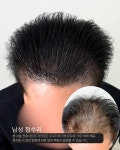 극동뷰티아카데미미용학원채원뷰티두피탈모센터 | 두피더하기