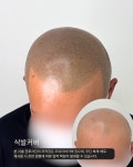 극동뷰티아카데미미용학원채원뷰티두피탈모센터 | 두피더하기