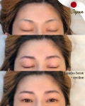 올스뷰티 눈썹문신 두피문신 헤어라인 인천송도본점