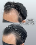 마노아비 뷰티샵 | 마노뷰티 눈썹문신&두피문신 울산남구점