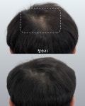 마노아비 뷰티샵 | 마노뷰티 눈썹문신&두피문신 울산남구점