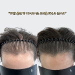마노아비 뷰티샵 | 마노뷰티 눈썹문신&두피문신 울산남구점