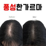 마노아비 뷰티샵 | 마노뷰티 눈썹문신&두피문신 울산남구점