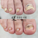 나디브대전도안동여우손톱점 | 네일밀랜드 풋풋한리쌤 대전도안점