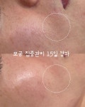 중흥S테틱 | 에스테틱원