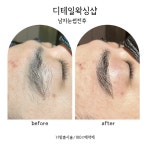 디테일왁싱