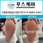 푸스케어수원이든네일 | 푸스케어 수원호매실점 네일가게
