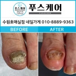 푸스케어수원이든네일 | 푸스케어 수원호매실점 네일가게