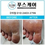 푸스양주 | 푸스케어 구리점