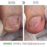 네일하이손톱발톱 | 포쉬네일 하이푸스 가로수길점