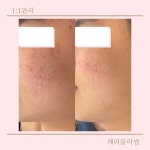 체리빌사우나스킨케어 | 체리블라썸 스킨앤바디
