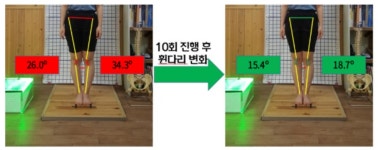 힐링나인틴척추교정원 | 힐링포스처 자세교정운동센터