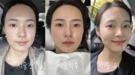 후기
