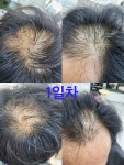 브이힐링헤어두피모발전문샵 | V힐링헤어두피모발전문샵