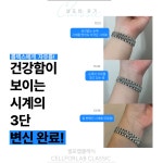 에스라인테라피