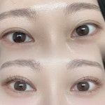 인셀덤알에스챠밍 | 퓨리밍뷰티