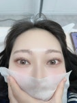 인셀덤알에스챠밍 | 퓨리밍뷰티