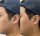 리그로브 왁싱(Regorve waxing) | 리그로브왁싱