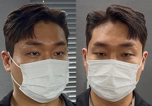 옴므 맨즈 헤어(Homme Man's Hair) | 옴므유 맨즈헤어 &위그유가발