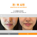 키웰구월 | 키웰 인천구월점