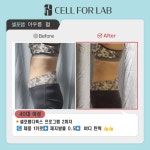 에스라인테라피