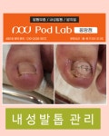 에벤에셀두피관리&발관리 | 케어센터 포디랩응암점 내성 무좀 발각질 두피관리 젤네일