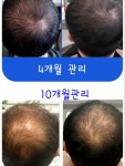 코지헤어.탈모두피센타 | #염색#두피(탈모)관리#염색센타#