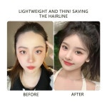 전정아헤어라인 | 이마 헤어라인 패치 초박형 내추럴 인비저블 무스카트 라누고 앞머리 가능 2 개 자연 색상 : 키타야마마켓